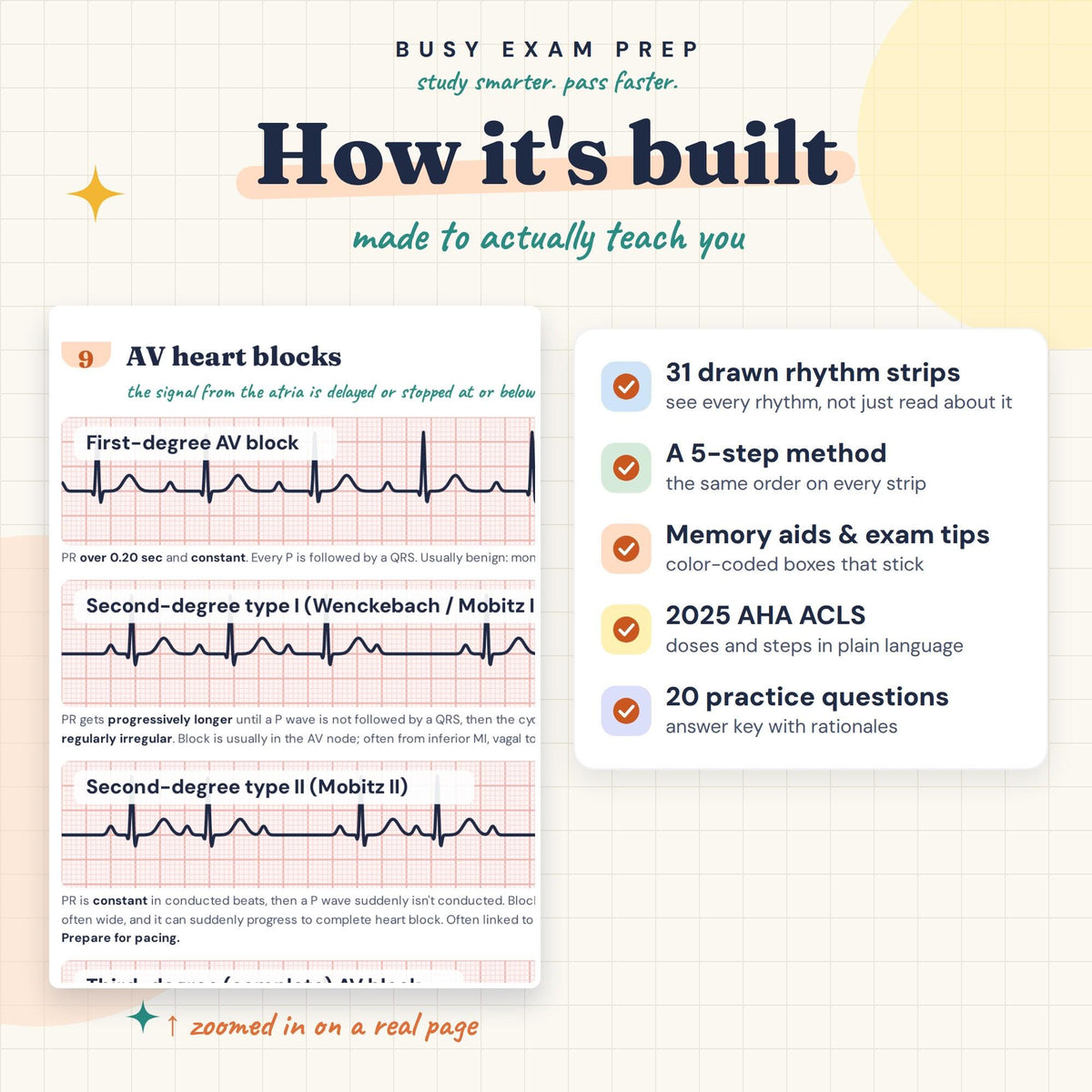 EKG Rhythm Strips Study Guide learning features