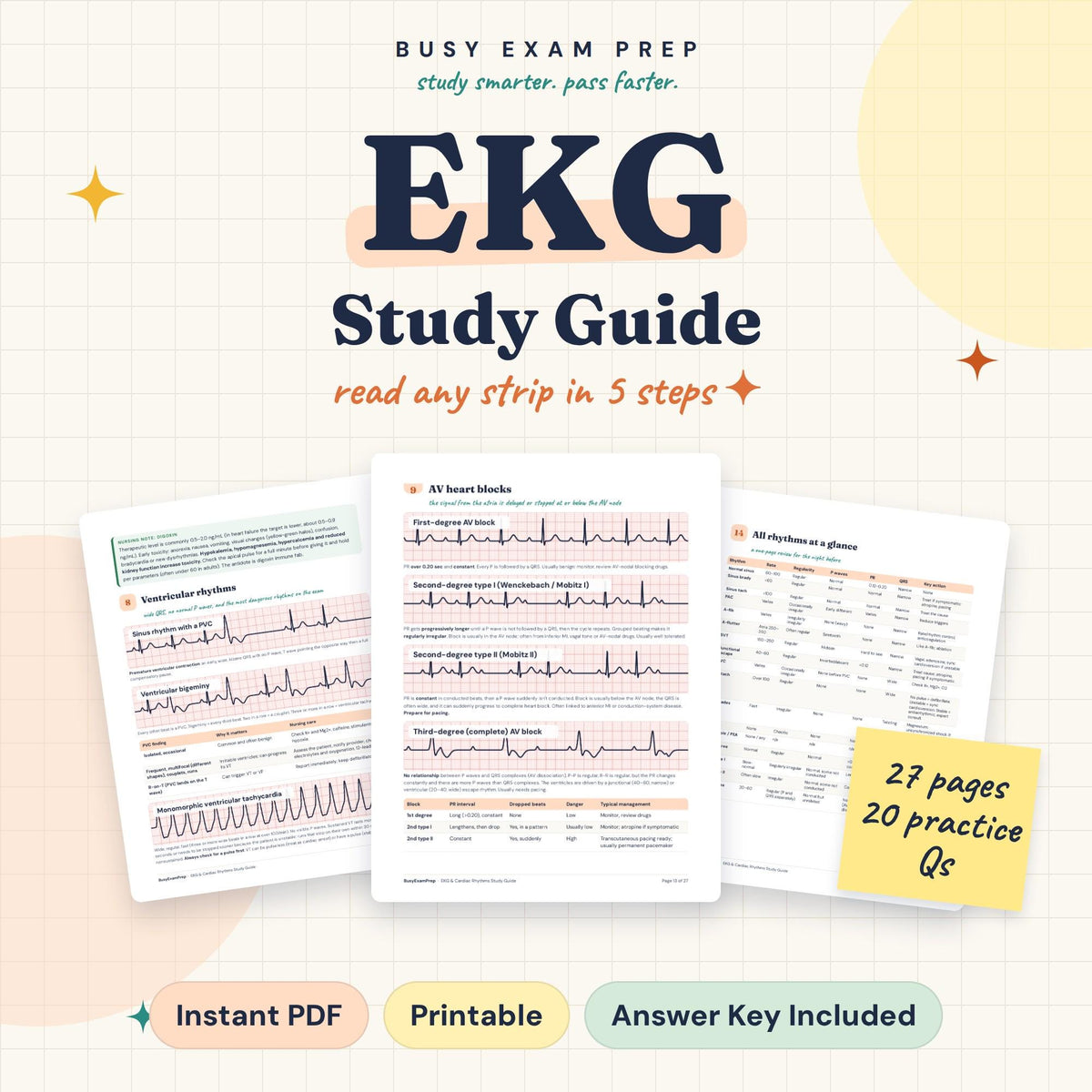 EKG Rhythm Strips Study Guide digital cover