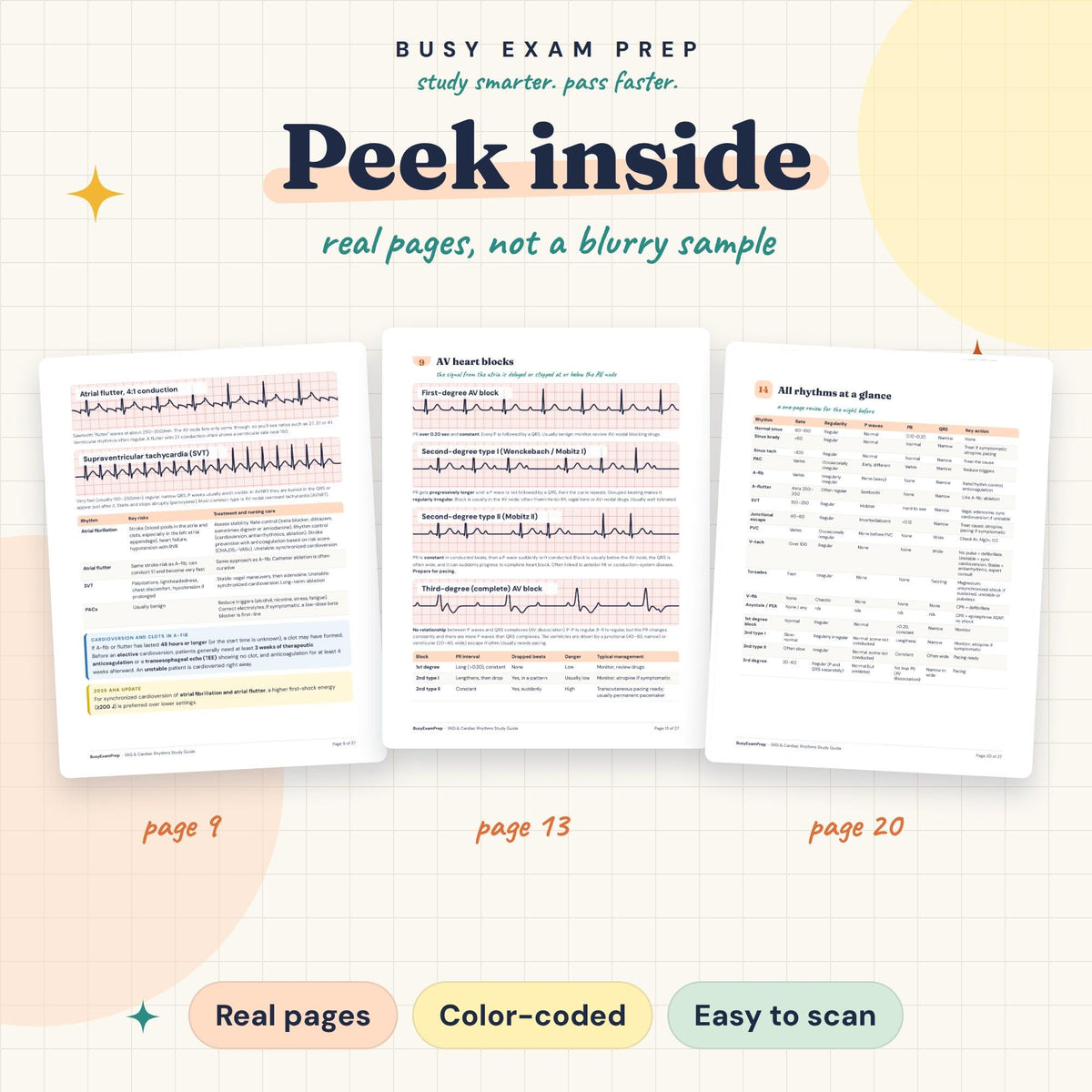 EKG Rhythm Strips Study Guide existing interior preview